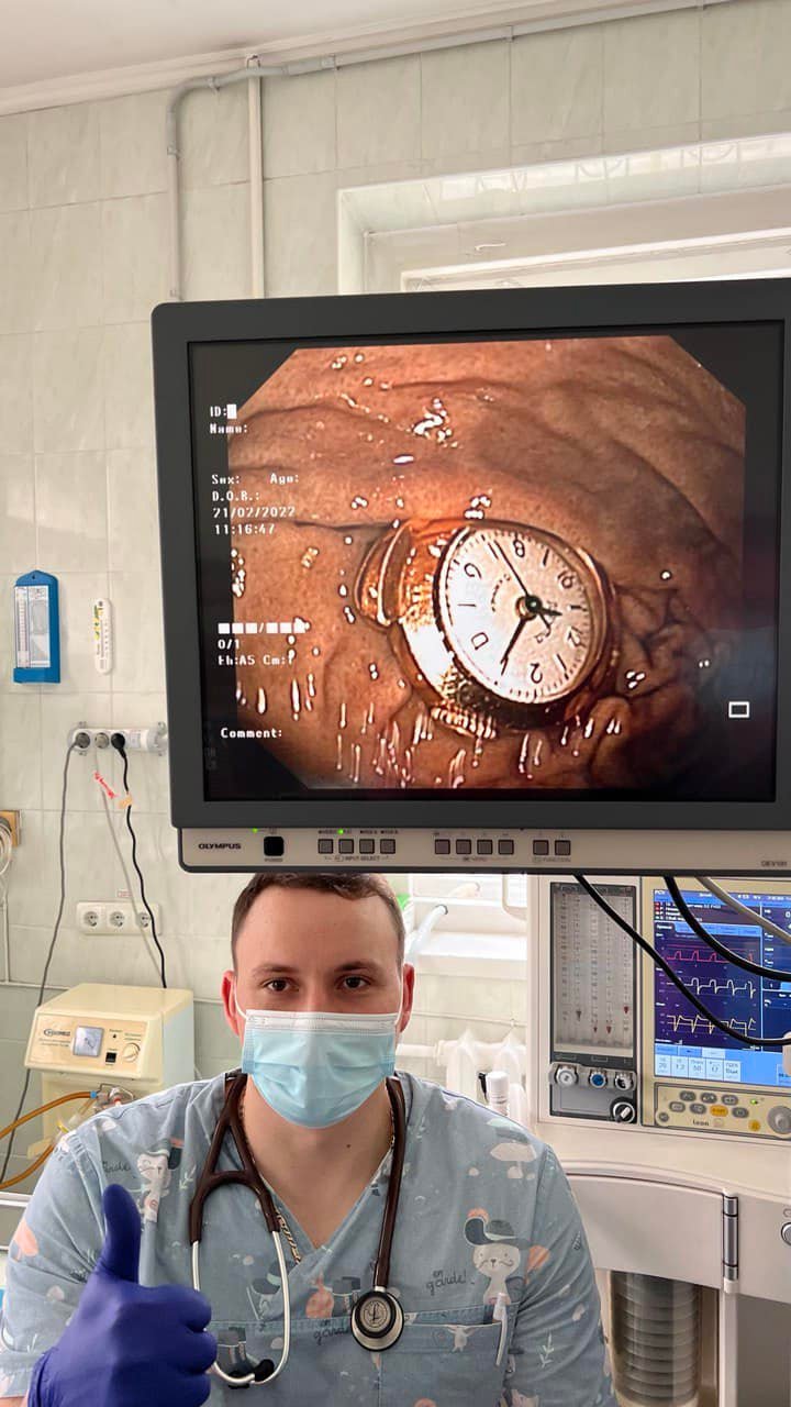 В Киеве врачи спасли 3-летнего мальчика, который проглотил часы (фото)