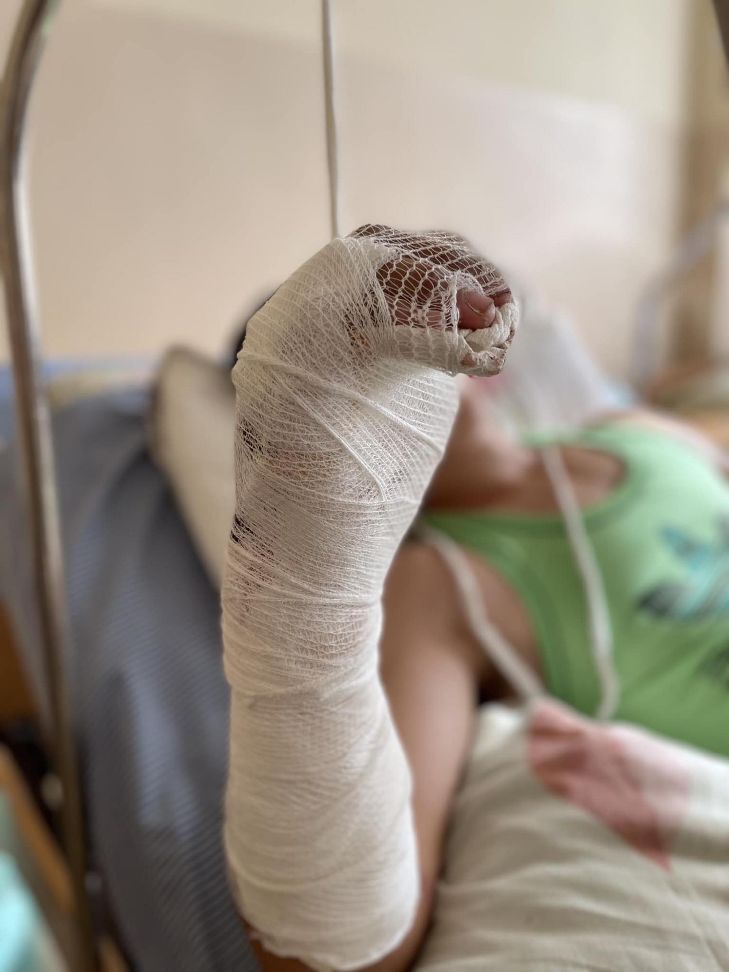 Вперше працювали з такою складною травмою: у Львові лікарі дивом врятували хлопцю руку