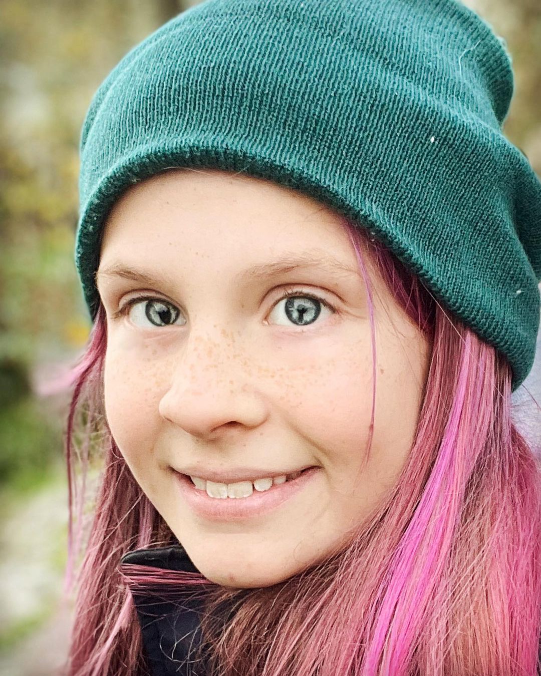 Вот как выглядят люди с генетическим дефектом глаз, который делает взгляд &quot;змеиным&quot;