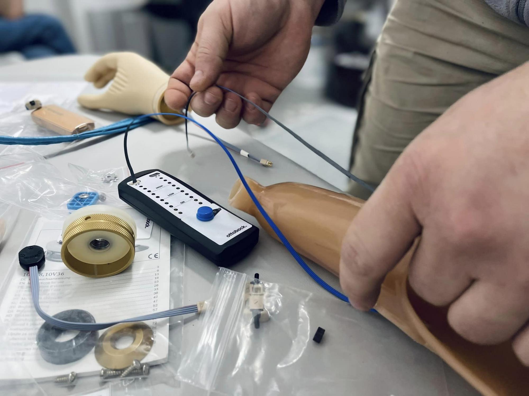 У Львові запустили дитяче протезування. Ось зворушливі фото першого щасливого пацієнта