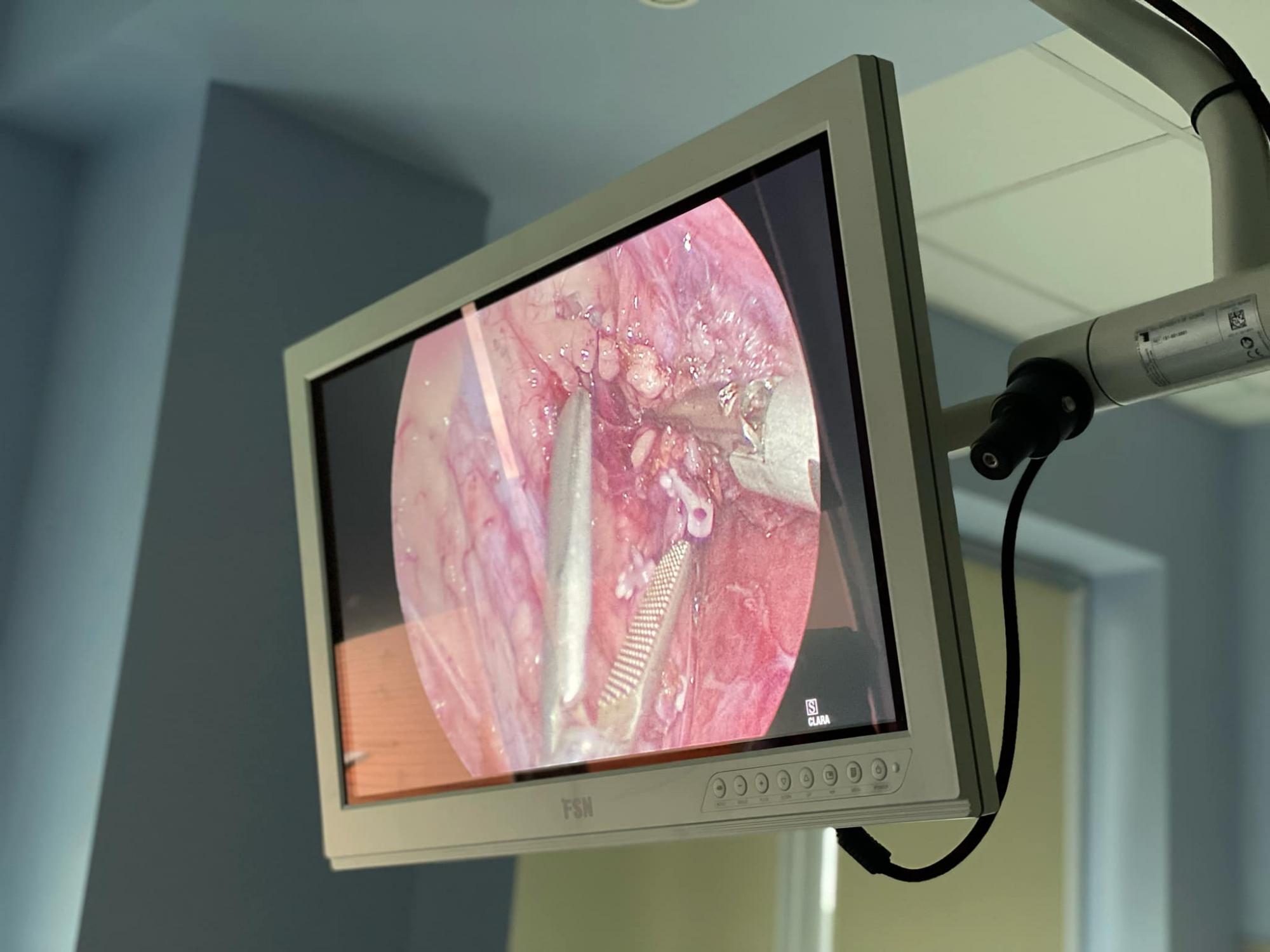 Украинские врачи уникальным способом спасли ребенку жизнь: что они сделали