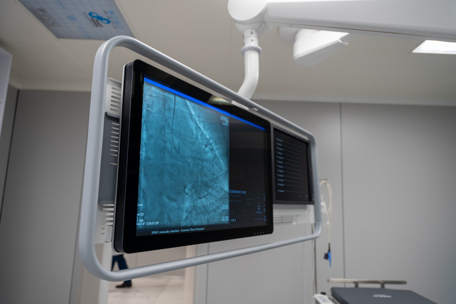 В больнице под Киевом установили новое оборудование, которое будет спасать жизни (фото)