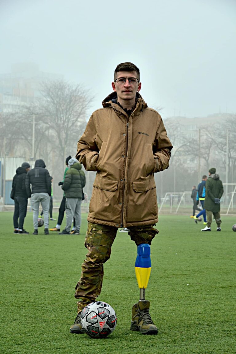 &quot;Хочу бути на рівних&quot;. Військовий ЗСУ розповів про труднощі життя з протезом та реакцію оточення (фото)