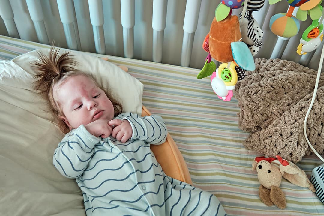 В Охматдете спасли малыша с разъединенным пищеводом: Ростик впервые начал есть в 7 месяцев