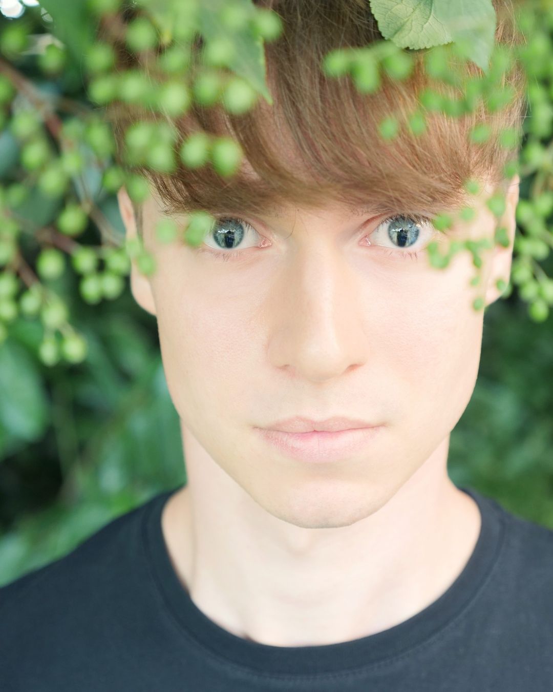 Вот как выглядят люди с генетическим дефектом глаз, который делает взгляд &quot;змеиным&quot;