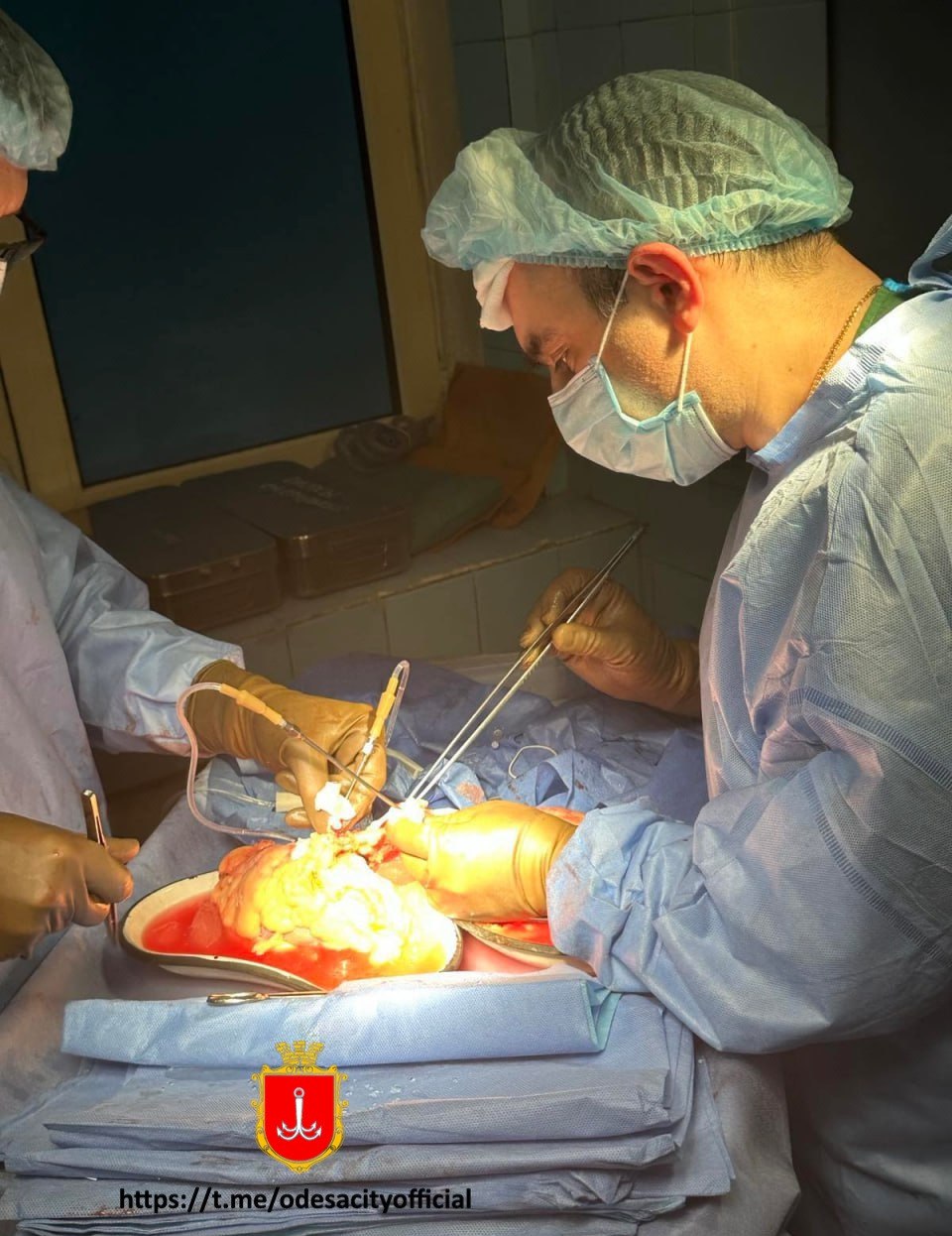 В Одесі вперше пересадили серце: як пройшла складна операція (відео і фото)