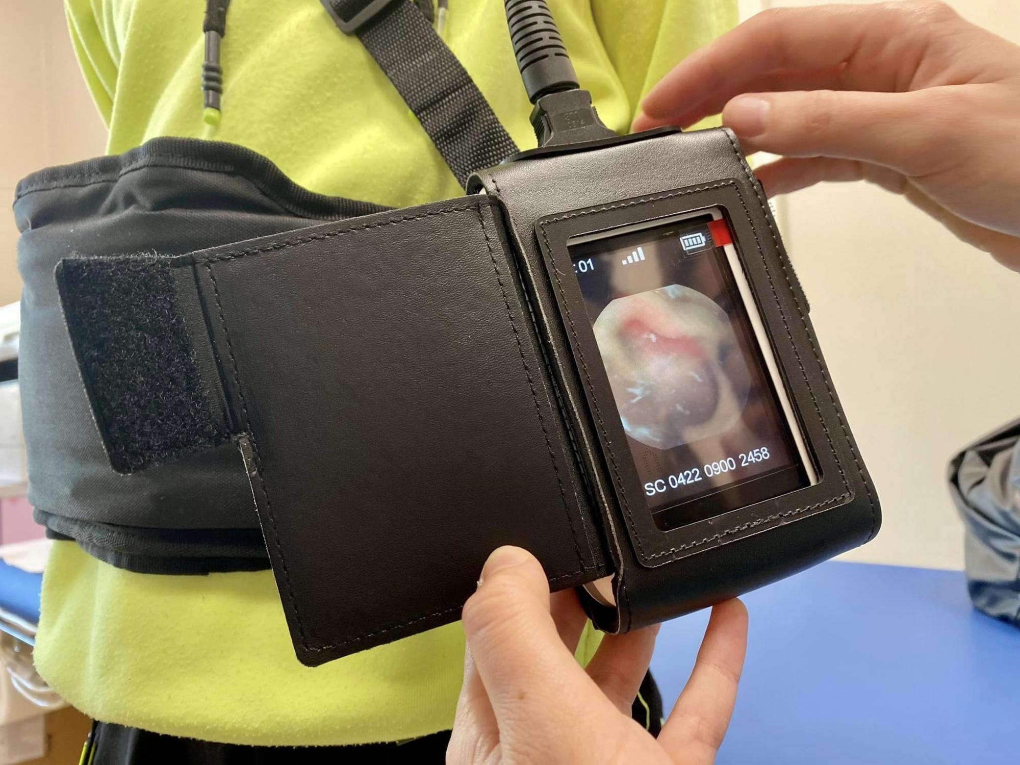 Лікарі у Києві перші в Україні використали новий метод обстеження дитини: у чому унікальність