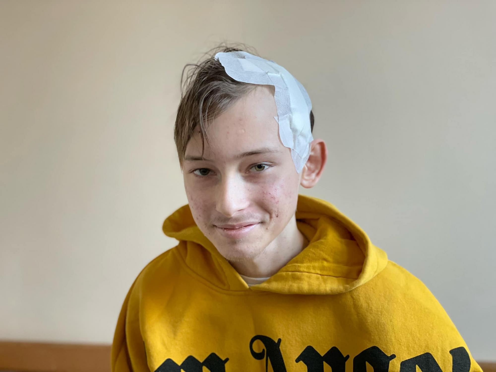 Дитина говорила під час втручання: в Україні вперше провели операцію на мозку з пробудженням