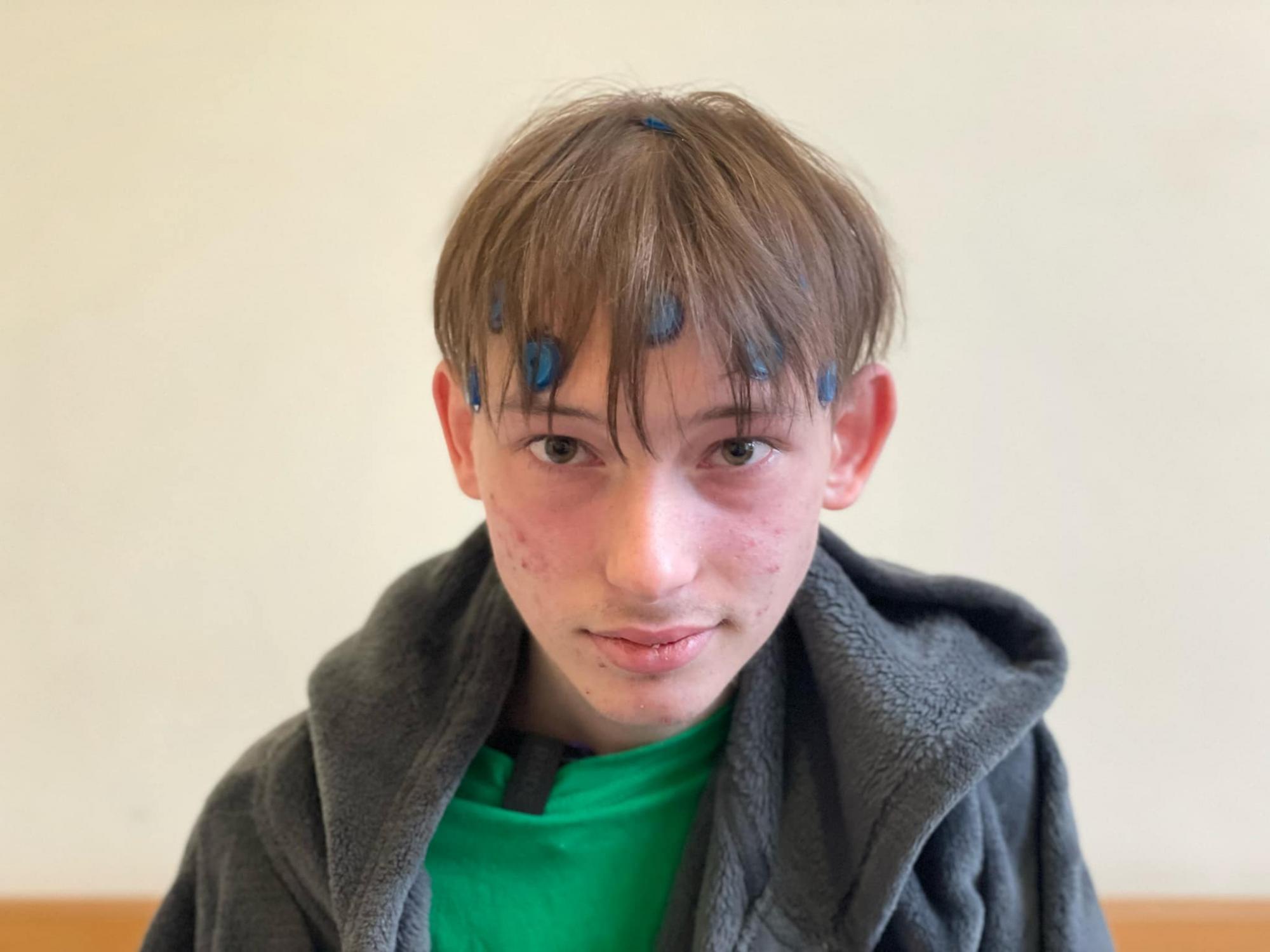 Дитина говорила під час втручання: в Україні вперше провели операцію на мозку з пробудженням