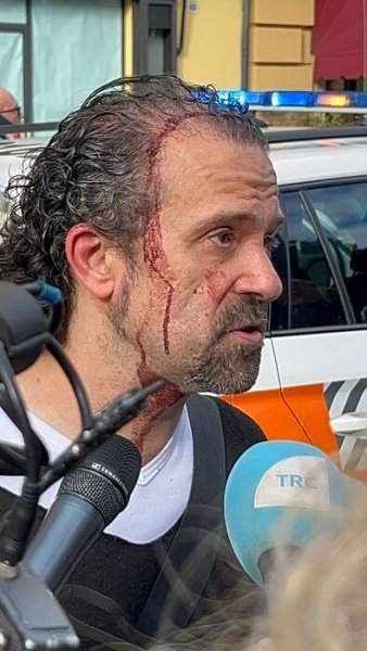 Driver crashes into crowd in Italy, then attacks bystanders with knife