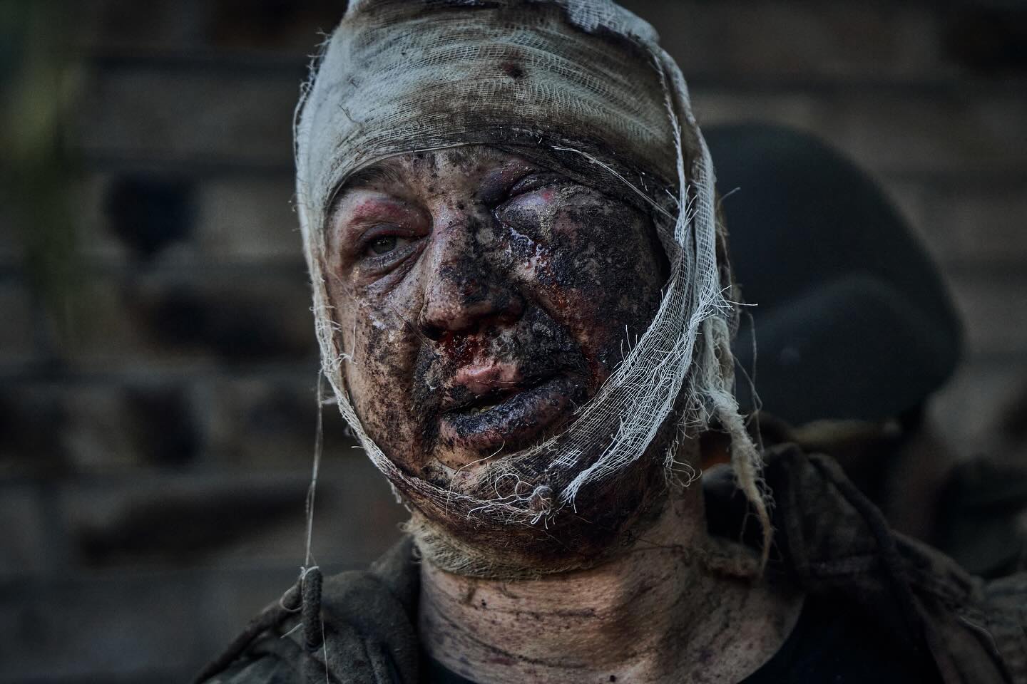 "Лица тех, кто выходит из ада". Фотографы поразили снимками наших защитников