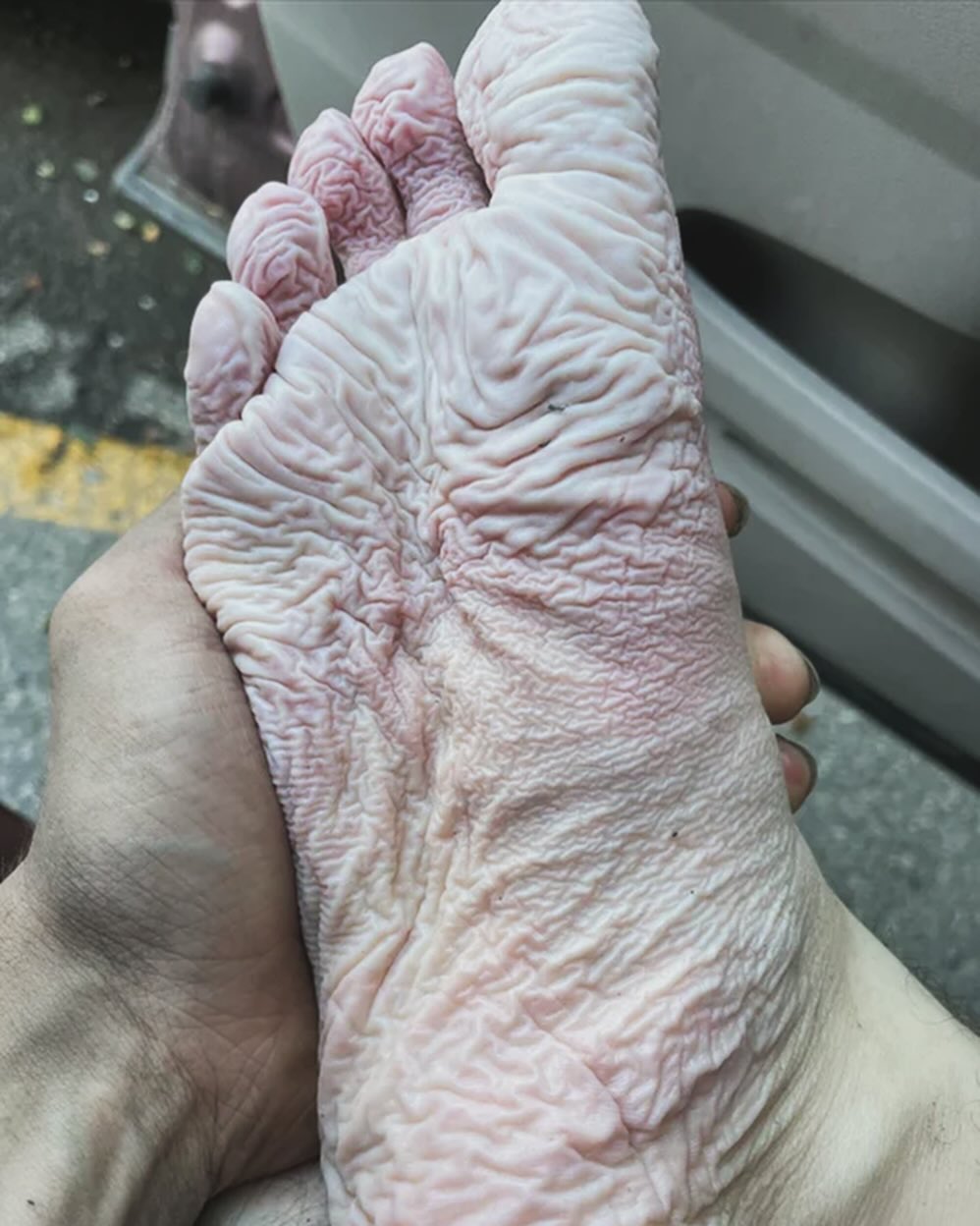 Часта проблема на війні: дерматолог розповіла, чому виникає &quot;окопна стопа&quot;