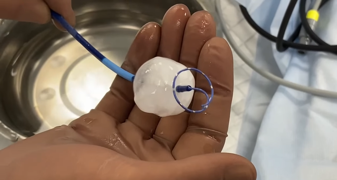 Впервые во Львове медики заморозили сердце, чтобы вылечить пациента (фото)