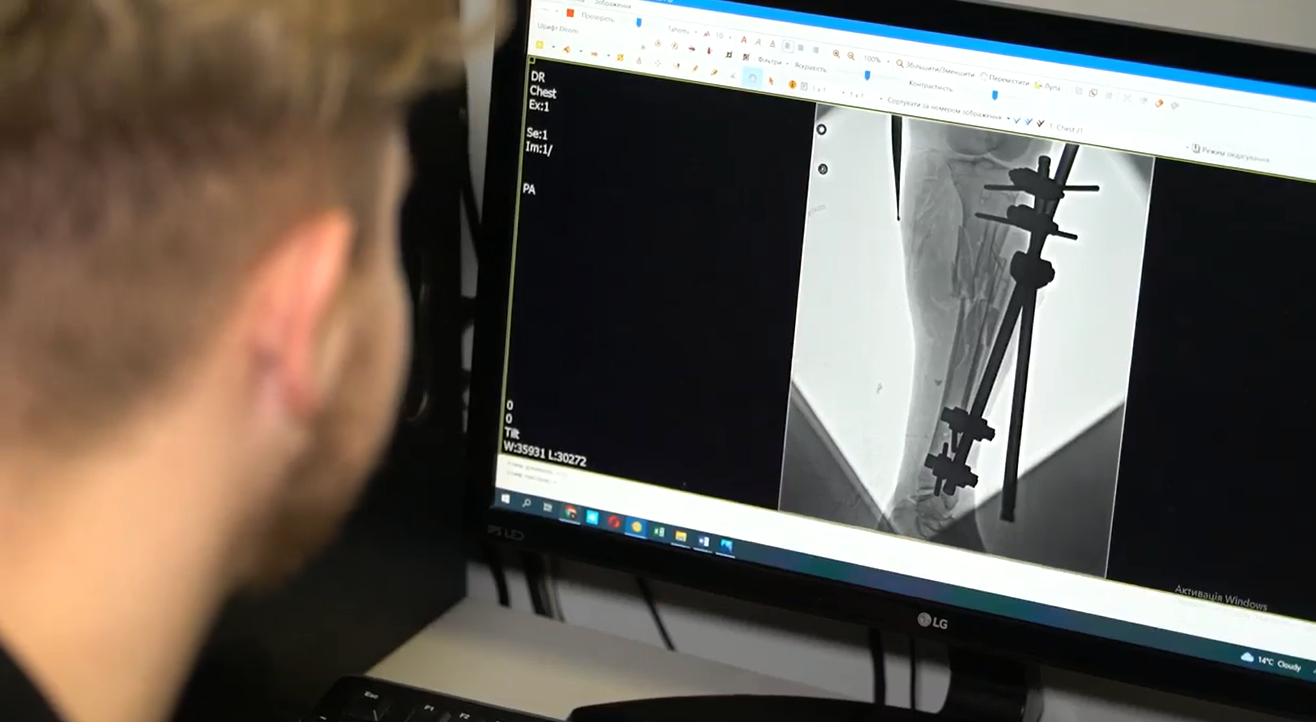 &quot;Родным сказали, что я погибла&quot;: во Львове спасли жизнь женщине из Бахмута