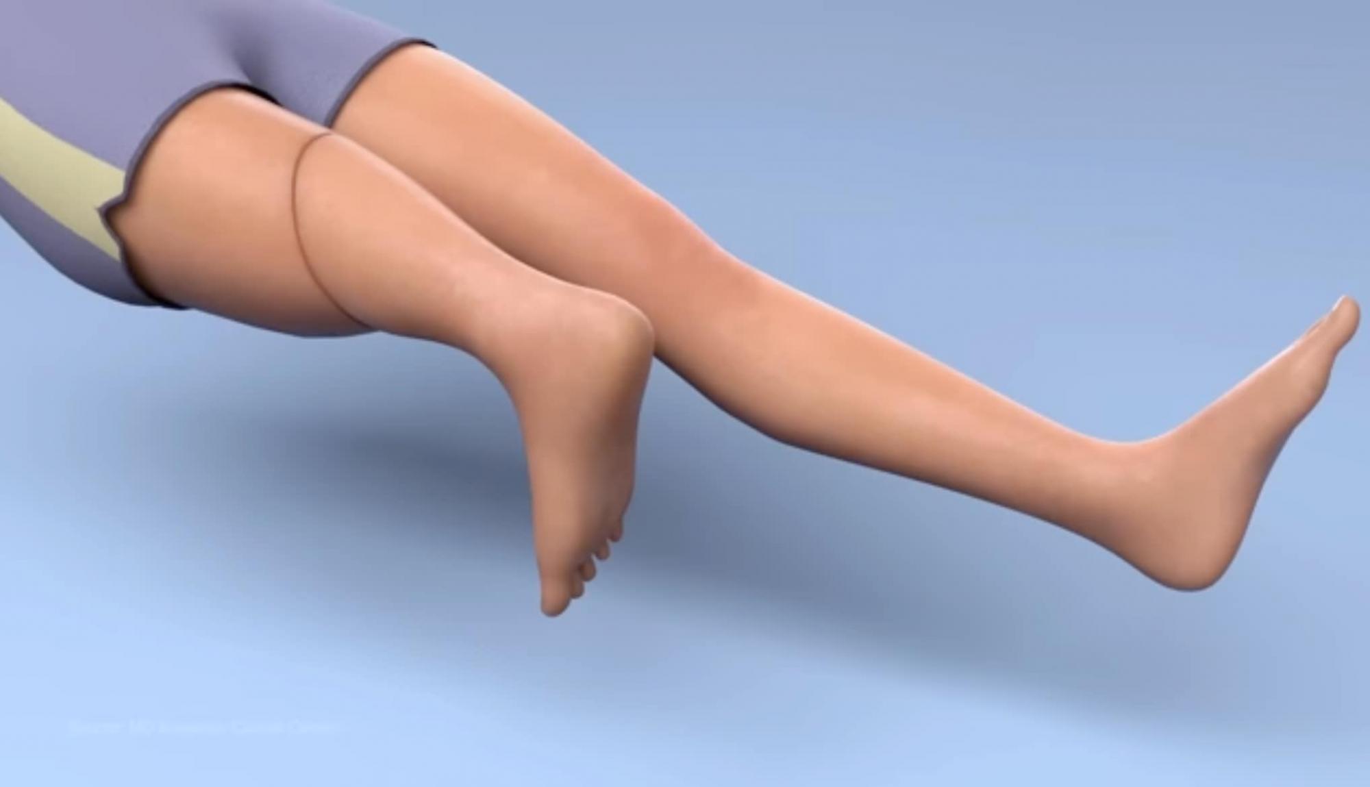 Только это могло спасти девушку с раком: в Украине врачи провели рискованную операцию