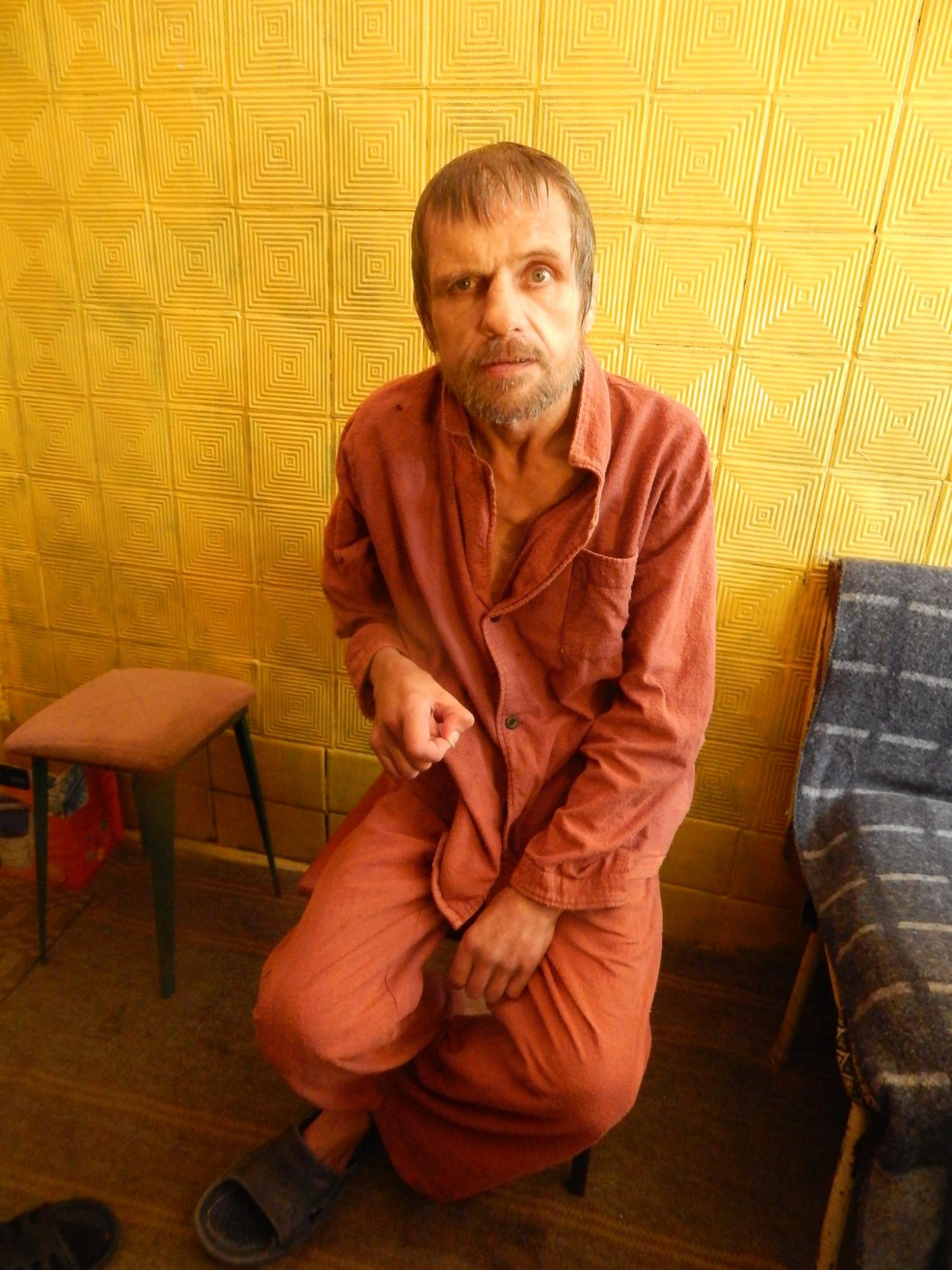 Українець із вм'ятиною в голові, якого лікували від бронхіту, помер у лікарні: жахливі деталі (фото)