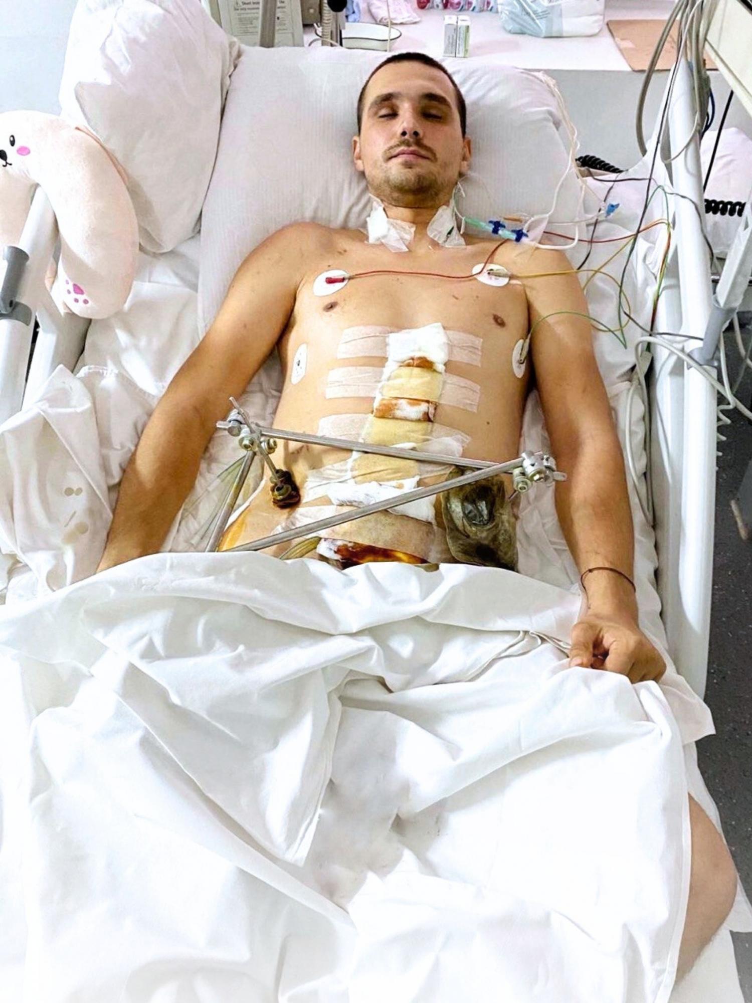 Больше года провел в больнице и перенес 60 операций. История воина с невероятной жаждой жизни