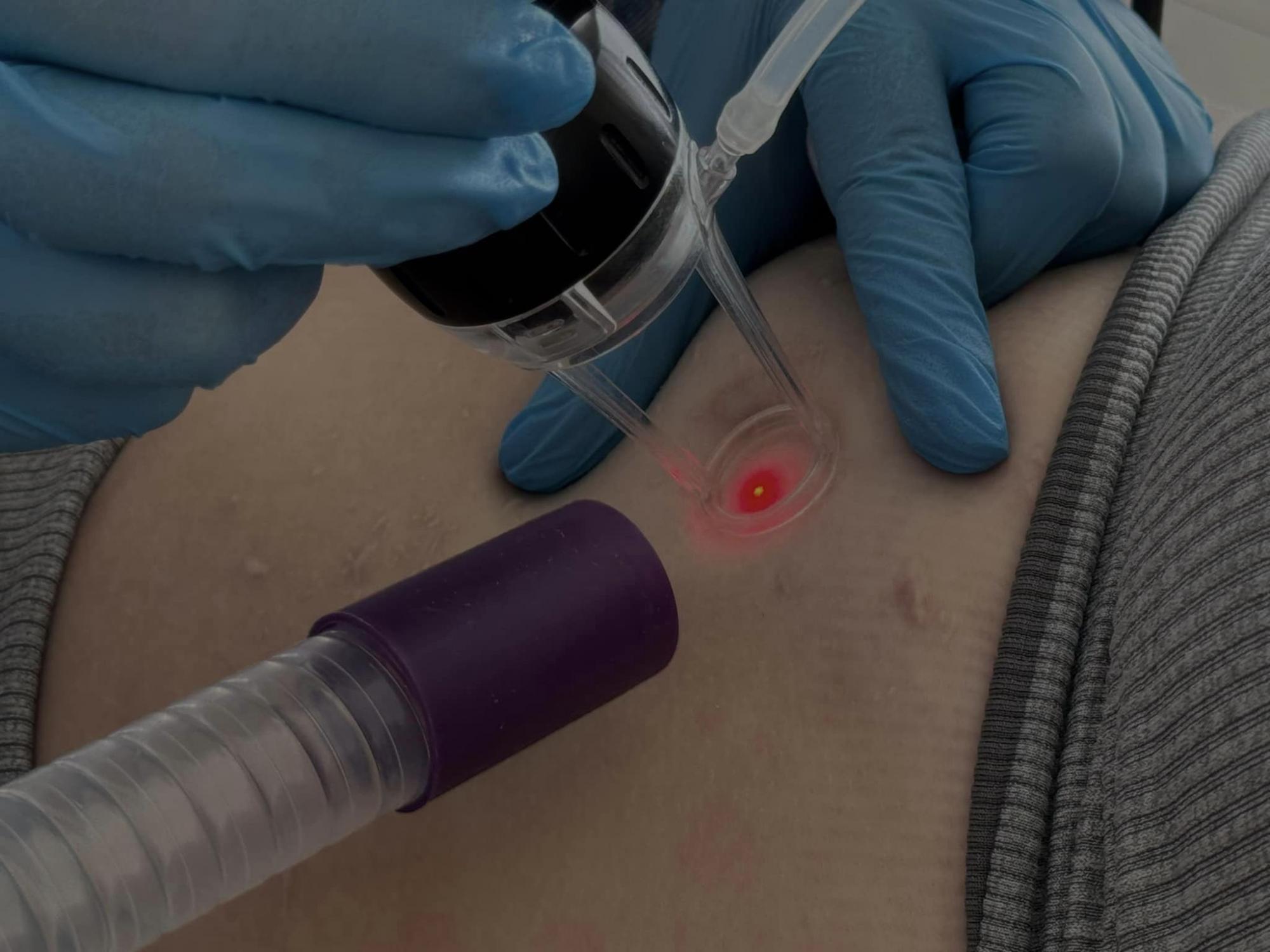 Ракета изувечила лицо: медики &quot;возвращают красоту&quot; 20-летней девушке перед свадьбой