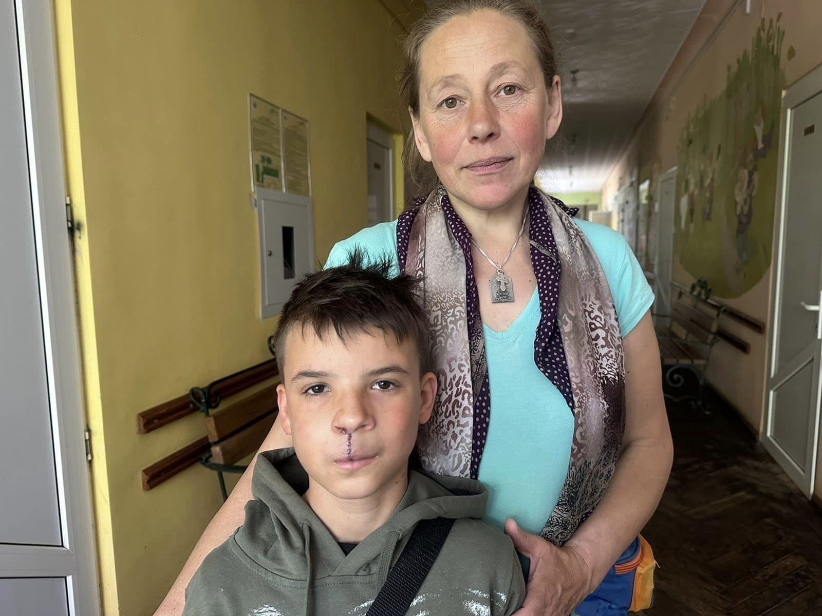 Называли кривоносым: во Львове хирурги из США сделали операцию сироте, которую он ждал всю жизнь