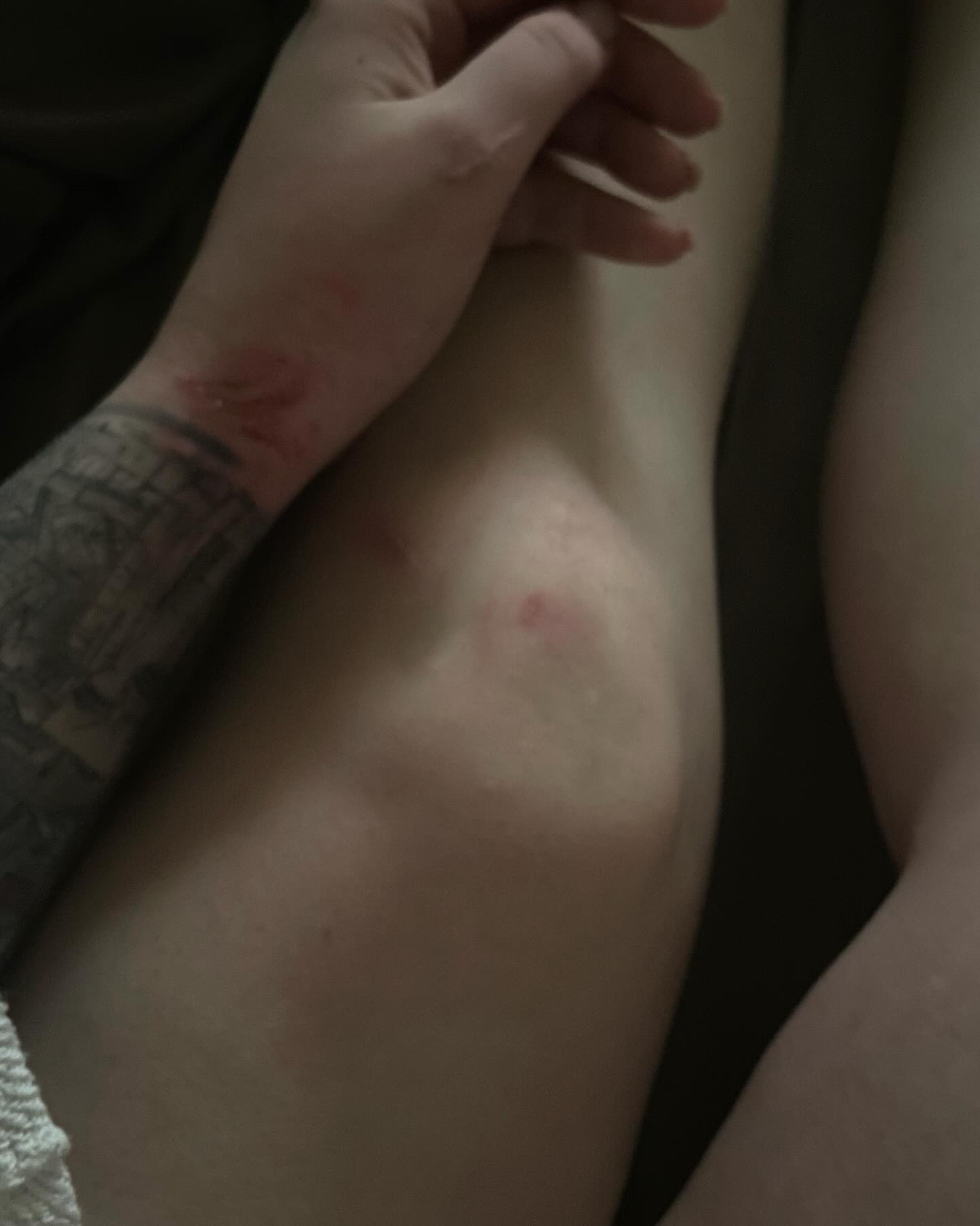 Знесло пів машини. "Пташка" Катерина Поліщук потрапила у серйозне ДТП