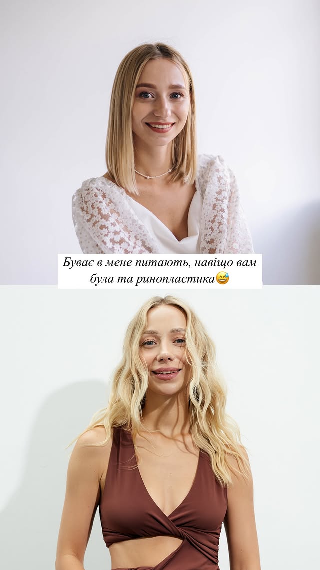 Дружина Віктора Павліка зізналася, що хоче у собі змінити: &quot;Мрію про дві операції&quot;