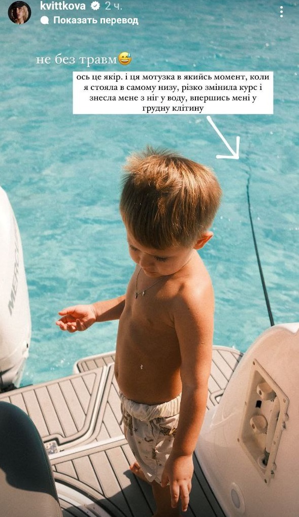 Даша Квиткова получила травму во время шикарного отдыха на яхте в Доминикане: фото последствий