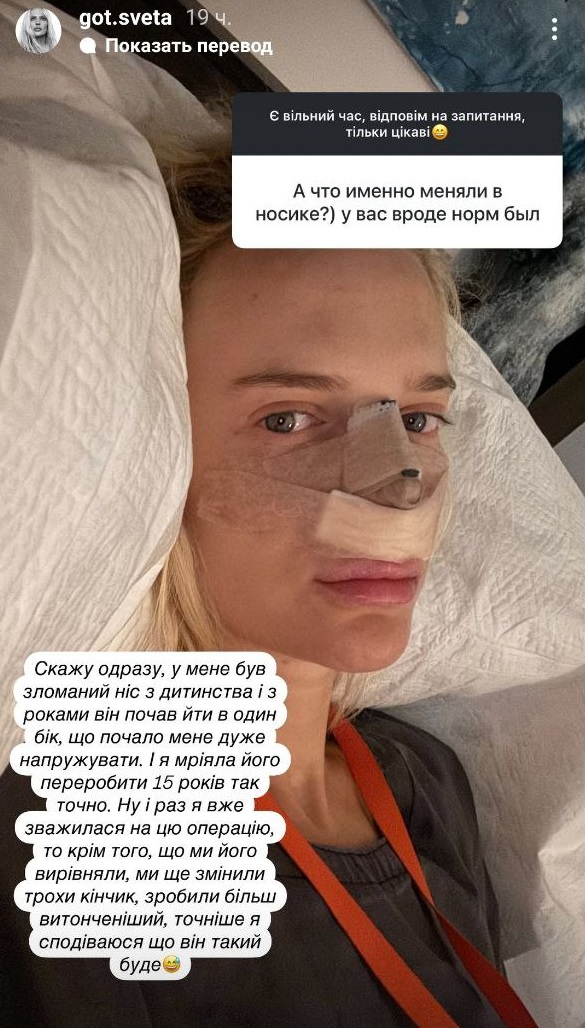 На фоне слухов о разрыве: избранница Цымбалюка сделала "пластику" и высказалась об актере