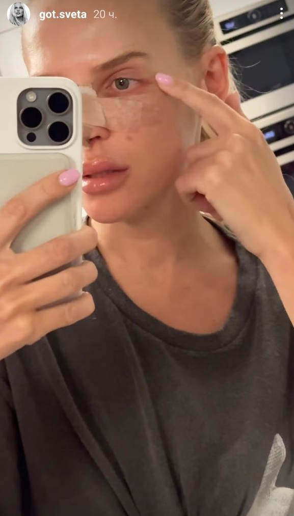 На фоне слухов о разрыве: избранница Цымбалюка сделала "пластику" и высказалась об актере