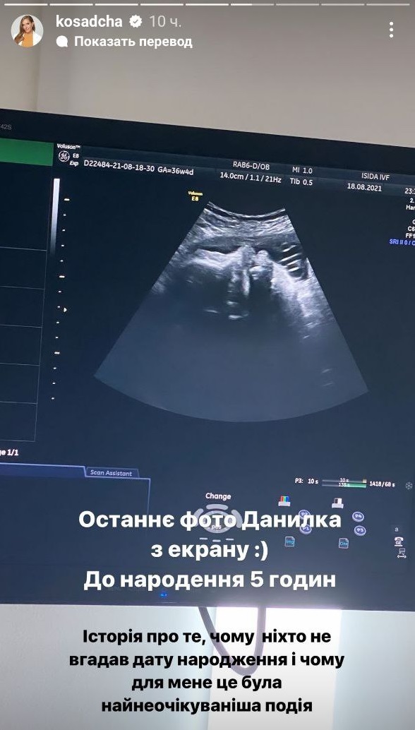 Горбунов восхитил снимками с младшим сыном в его день рождения: редкие фото