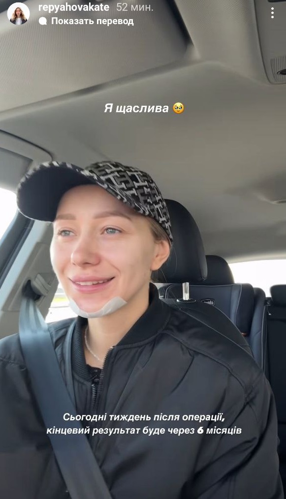 Жена Виктора Павлика похвасталась новым лицом после "пластики": как она выглядит