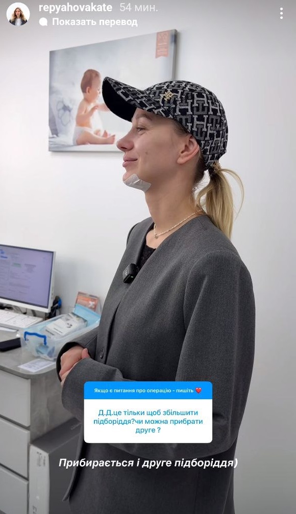 Жена Виктора Павлика похвасталась новым лицом после "пластики": как она выглядит