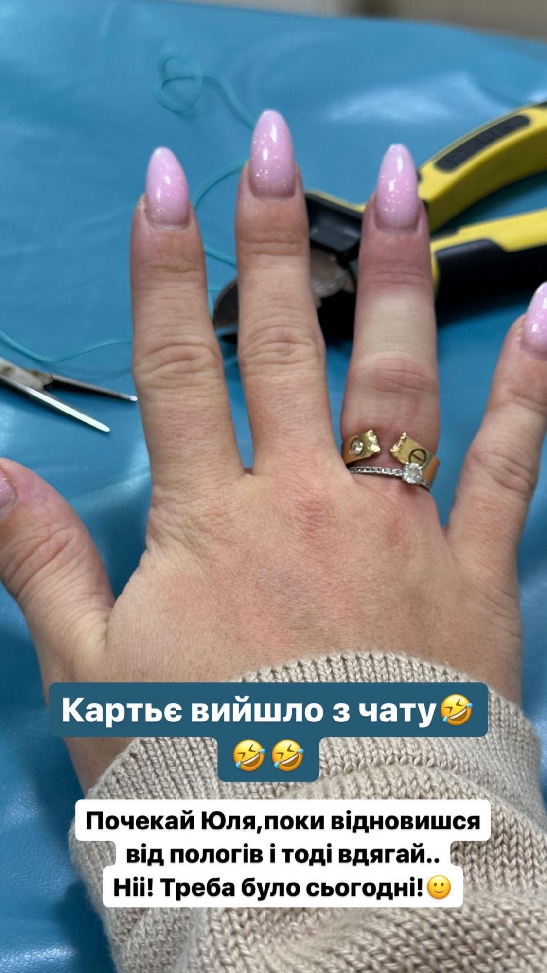 Юля Верба попала в больницу из-за дорогого кольца Cartier: что произошло