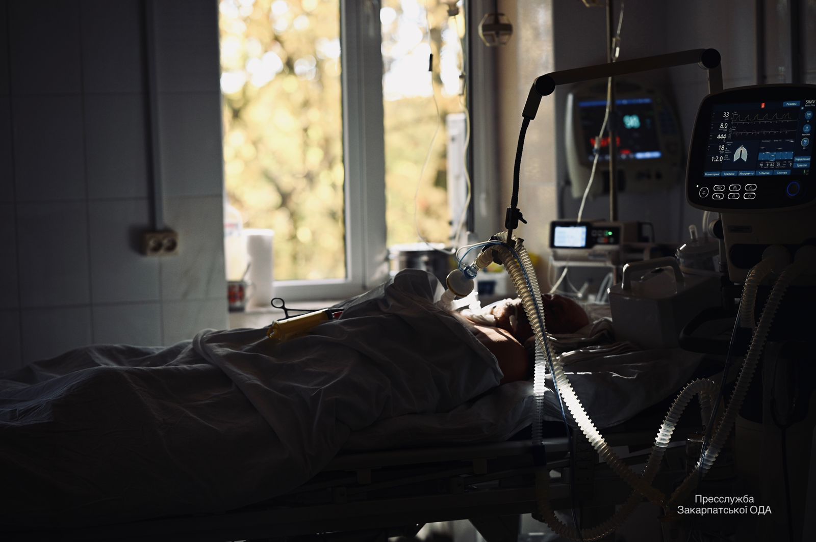 Моторошні фото із COVID-реанімації на Закарпатті: "виживає лише 1 з 10 пацієнтів, під’єднаних до ШВЛ"