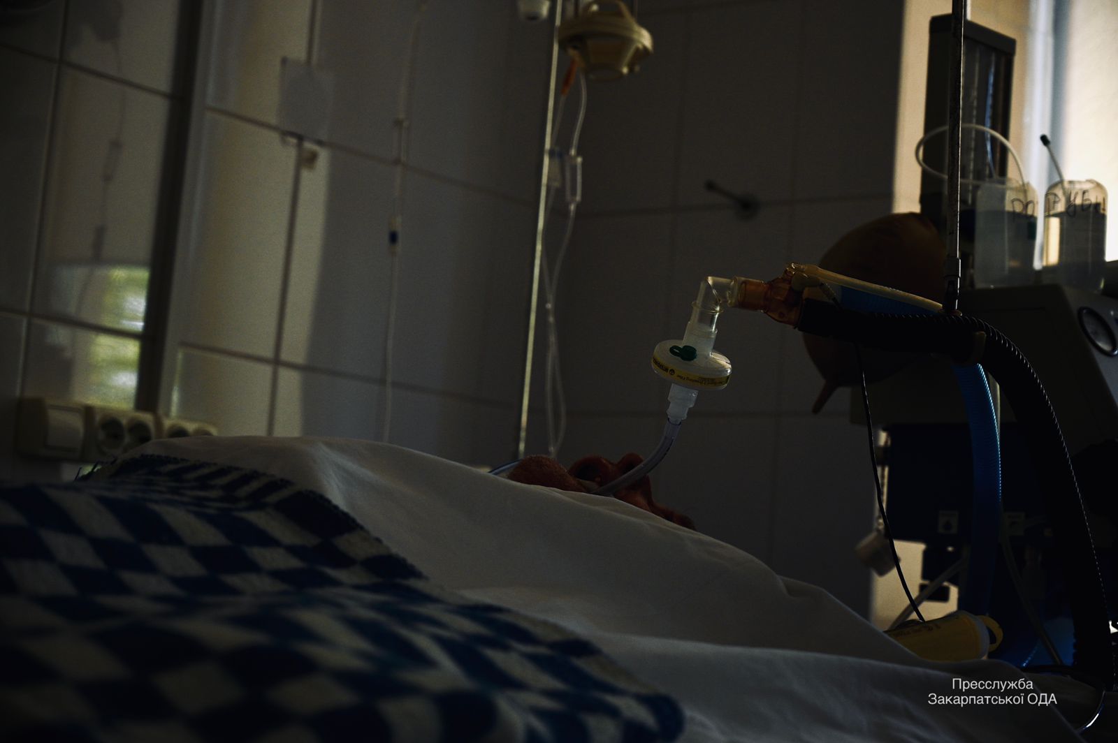 Моторошні фото із COVID-реанімації на Закарпатті: "виживає лише 1 з 10 пацієнтів, під’єднаних до ШВЛ"