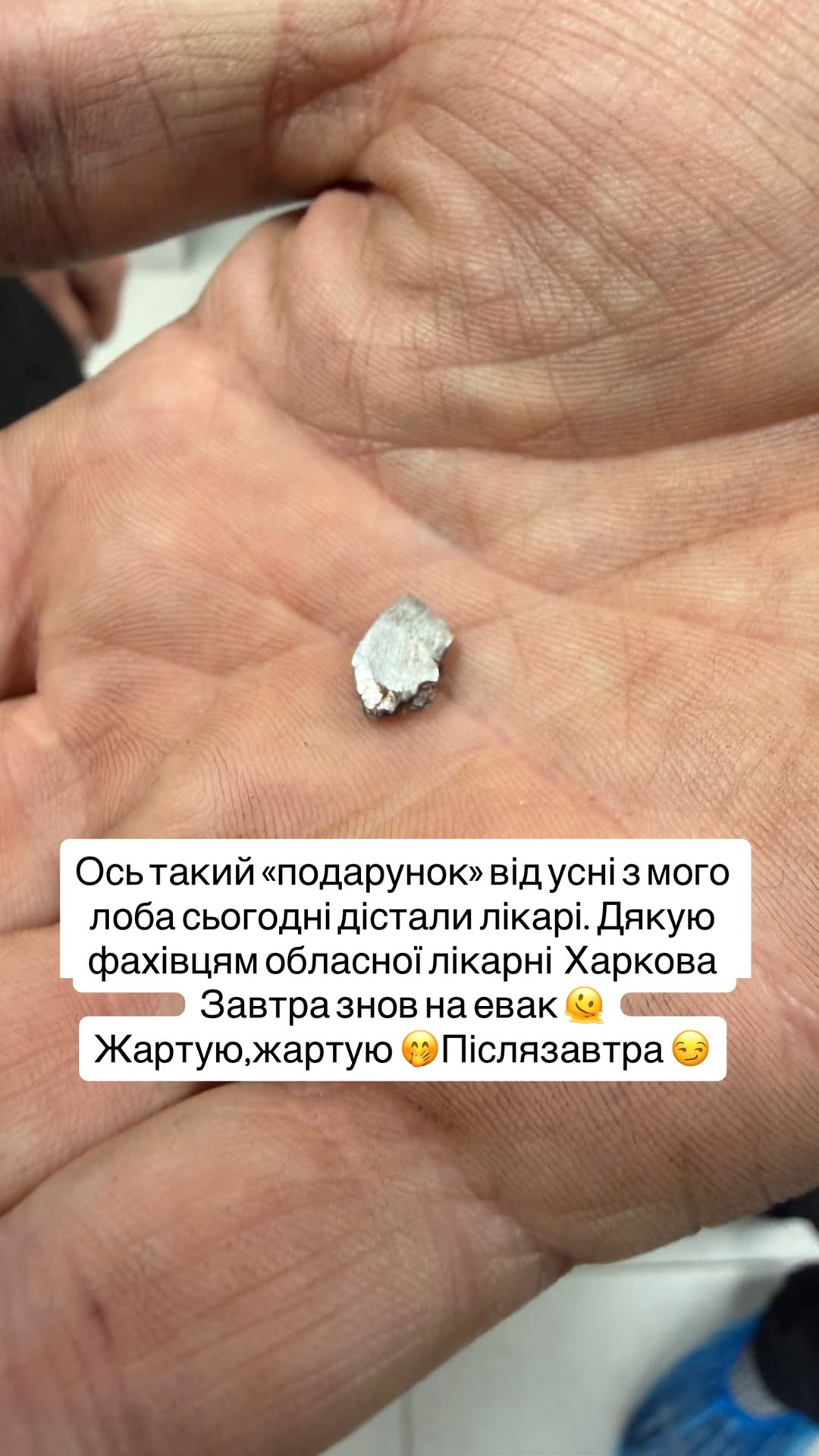 Ведущий и волонтер Христов попал под обстрел в Харьковской области: из его лба достали осколок