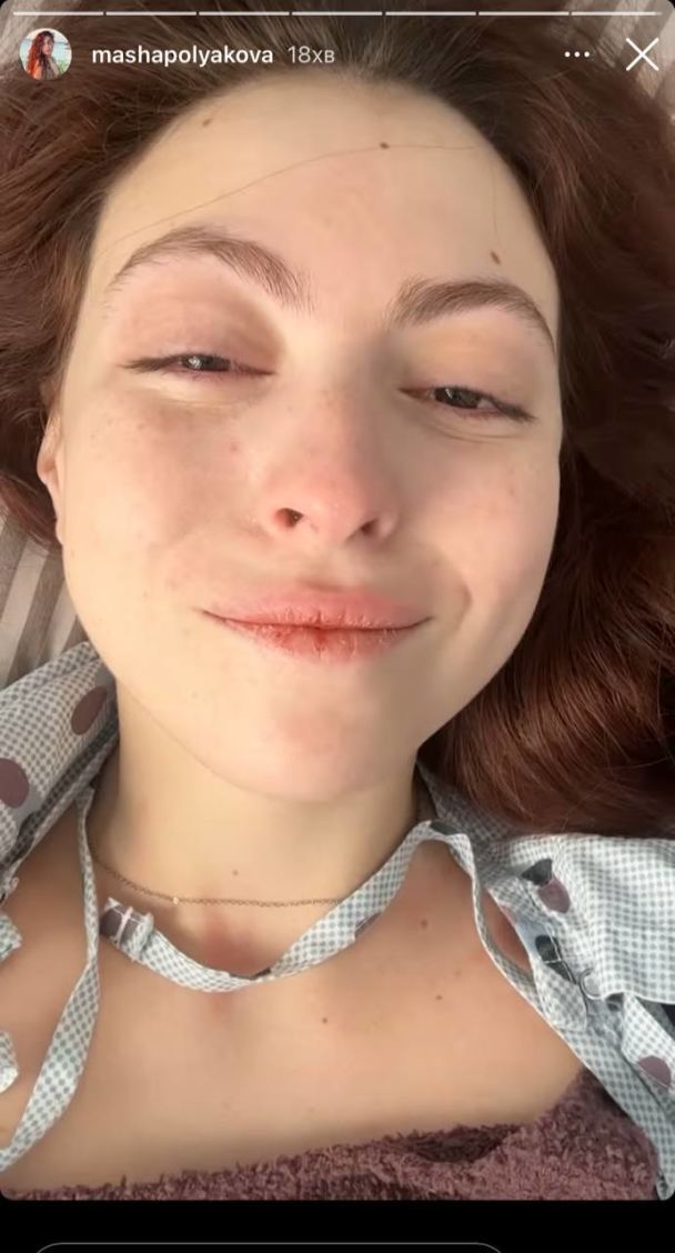 18-річна донька Олі Полякової перенесла операцію