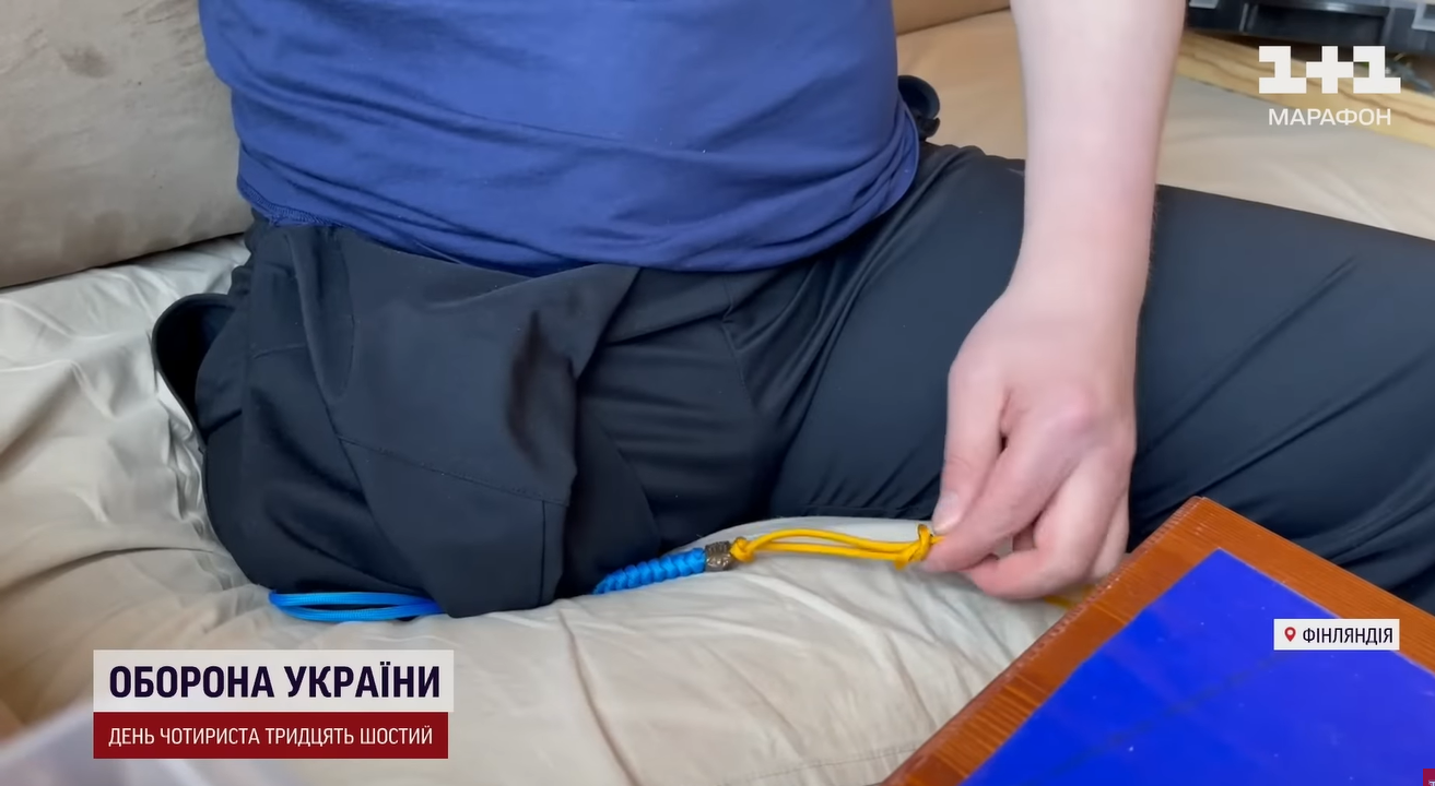 &quot;Боялися, що розсиплеться&quot;: лікарі врятували бійця ЗСУ з опіками, для яких немає класифікації