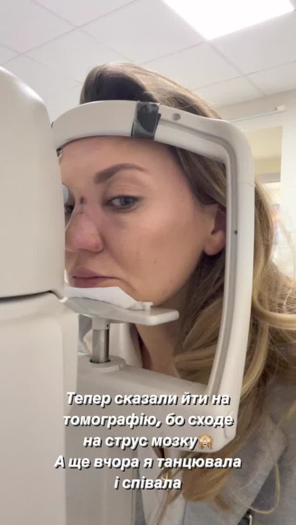 Зірка &quot;Квартала 95&quot; Саліванчук жахнула фото після перелому носа і струсу мозку
