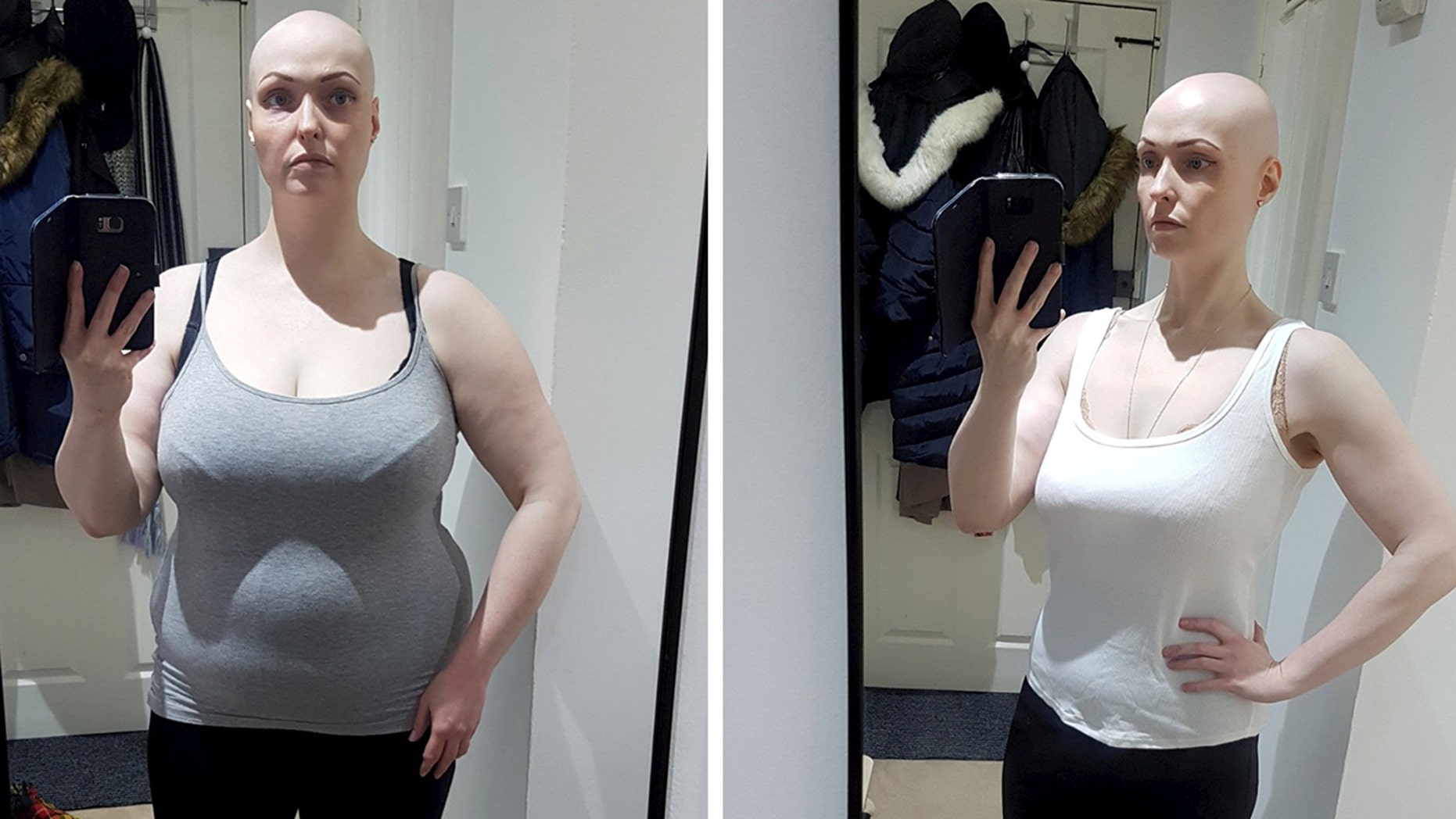 Отказ от одной привычки помог женщине похудеть на 36 кг за год: в чем ее секрет