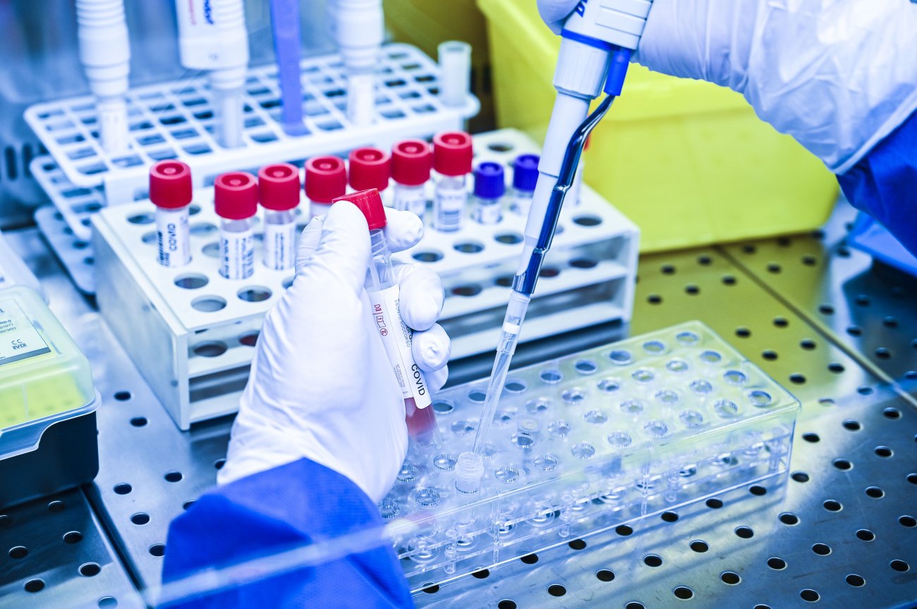 Штам "Омікрон". Чи небезпечна нова мутація вірусу та чого від неї чекати