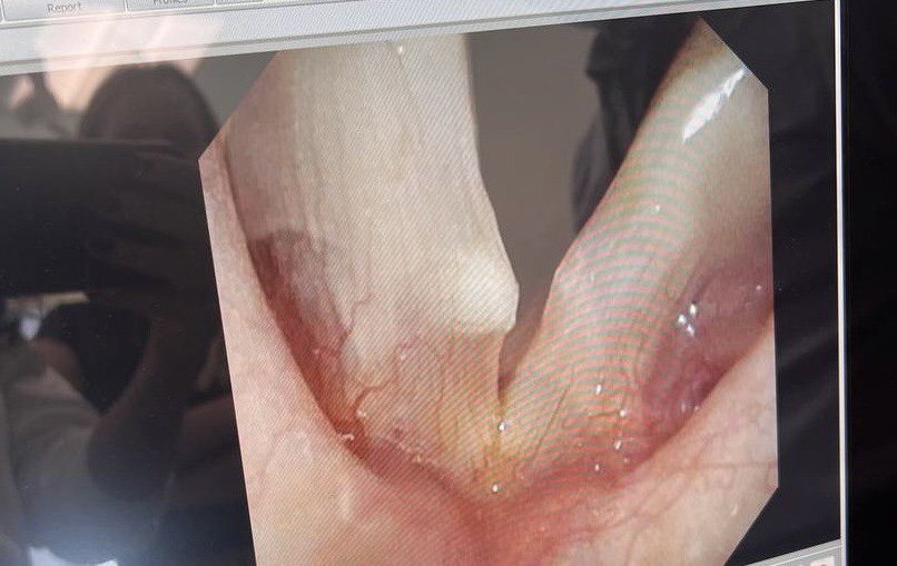 "Появилось новообразование". Настя Каменских ошеломила неприятной новостью: что случилось