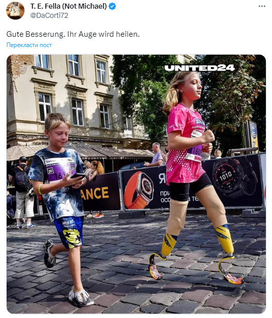 Шольц вперше показався після того, як упав лицем на асфальт. Йому нагадали про страждання українців