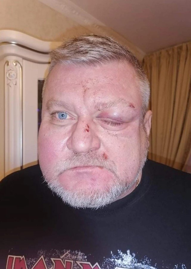 В Херсоне избили депутата: сделал замечание из-за петард