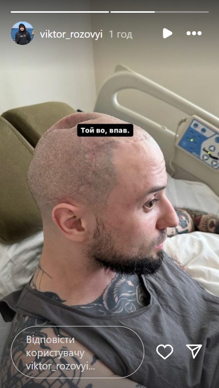 Звезда &quot;Лиги смеха&quot; Розовый впервые показал последствия тяжелого ранения (фото)