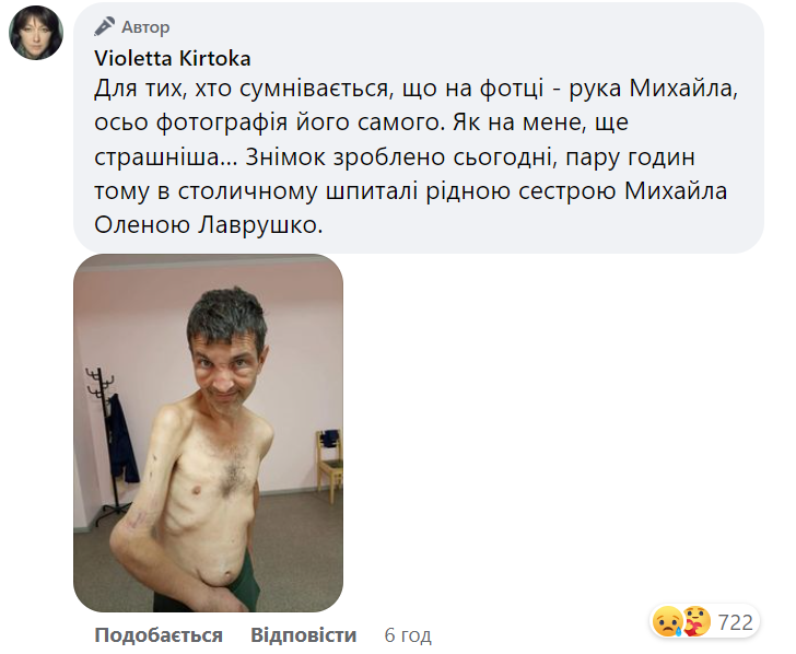 Українці за кілька годин зібрали мільйони на лікування героя "Азовсталі" Діанова