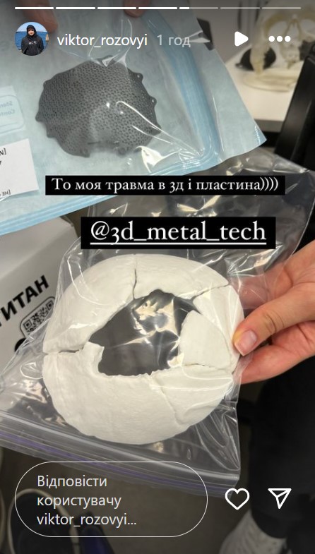 Комик Виктор Розовый раскрыл подробности реабилитации и вспомнил бой перед ранением (фото)