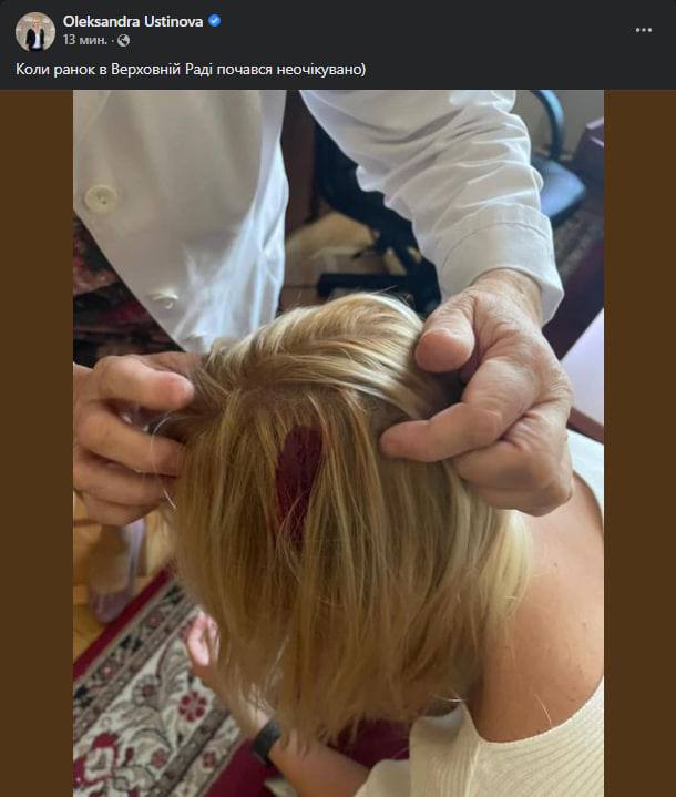 Нардеп розбила голову в Раді. Стала відома причина