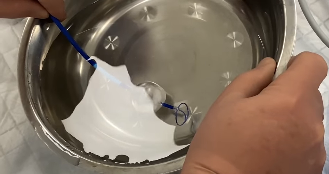 Впервые во Львове медики заморозили сердце, чтобы вылечить пациента (фото)