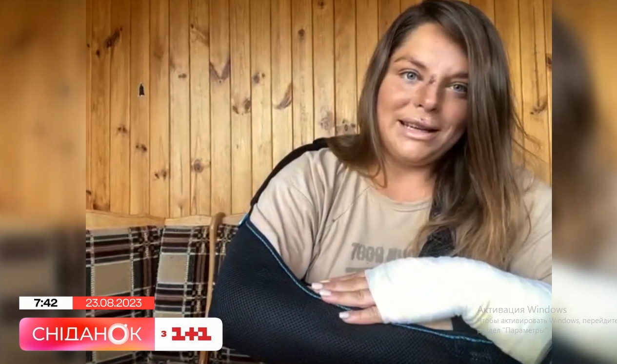 Зламана рука та розбите обличчя: відома українська ведуча шокувала зовнішнім виглядом