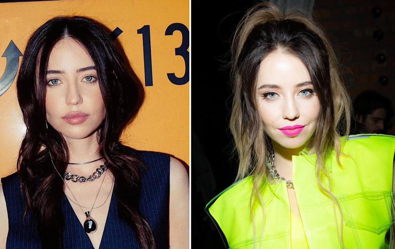 Фото Лесі Нікітюк, Наді Дорофєєвої та інших зірок до та після збільшення губ